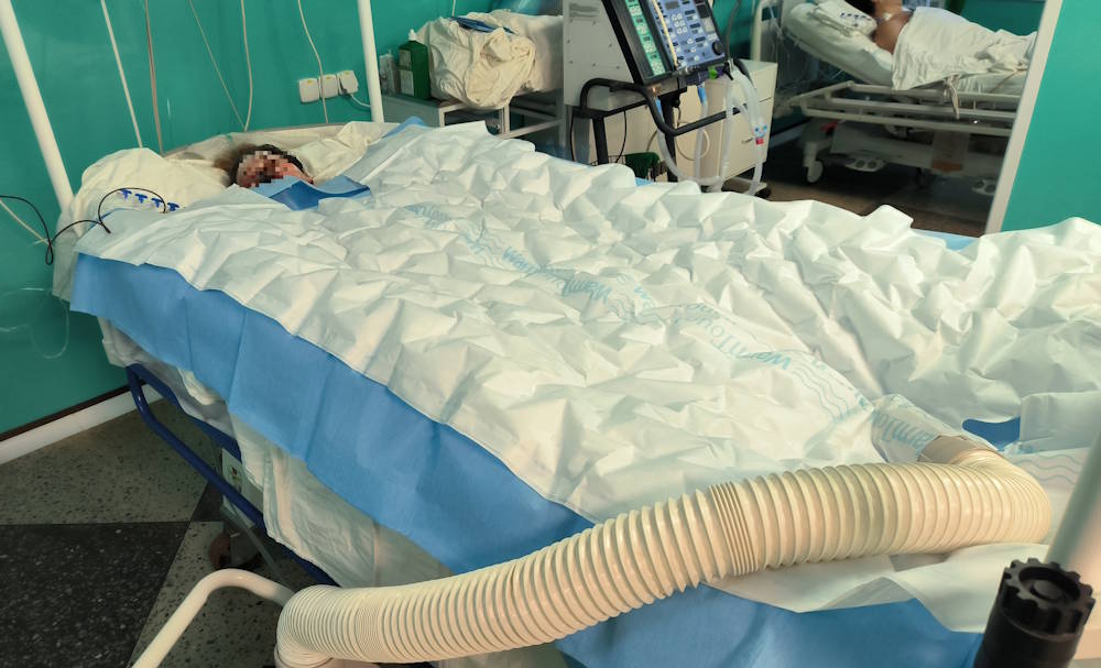 Пермские врачи спасли жизнь девочке с поражением 95% кожи на теле