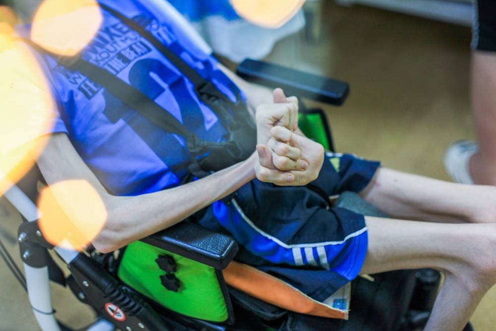 В Перми собирают помощь мальчику, который весит 14 кг в 14 лет